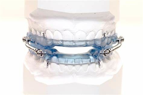 Teste padrão de parâmetros parciais para aparelhos de higiene oral: GB 4706.59-2008
